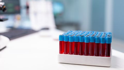 ARST SOOVITAB ⟩ Enne antidepressantide ja ATH ravimitega alustamist tee need vereanalüüsid