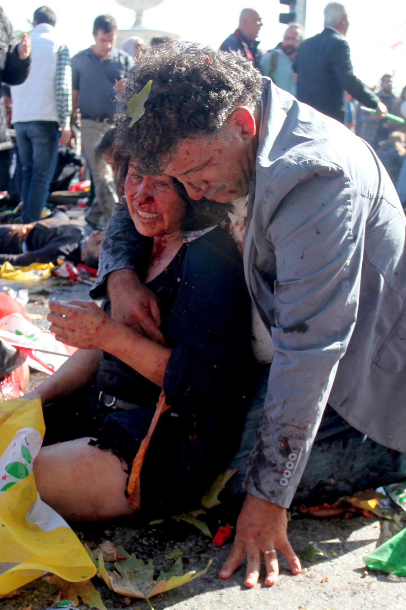 10. oktoobril 2015 Ankaras toimunud plahvatuses vigastada saanud.