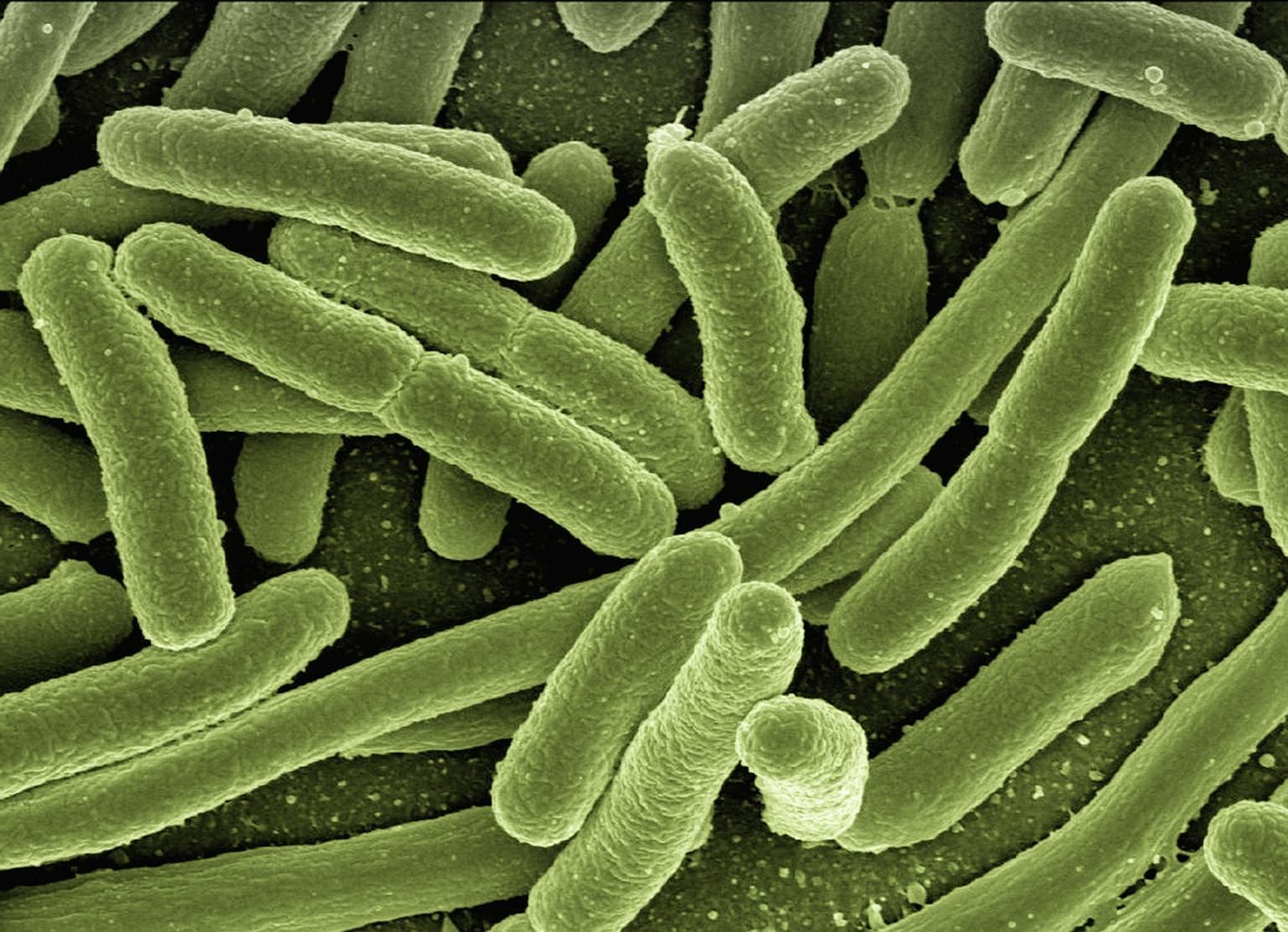 Soolekepikesed ehk kolibakterid mikroskoobi all.