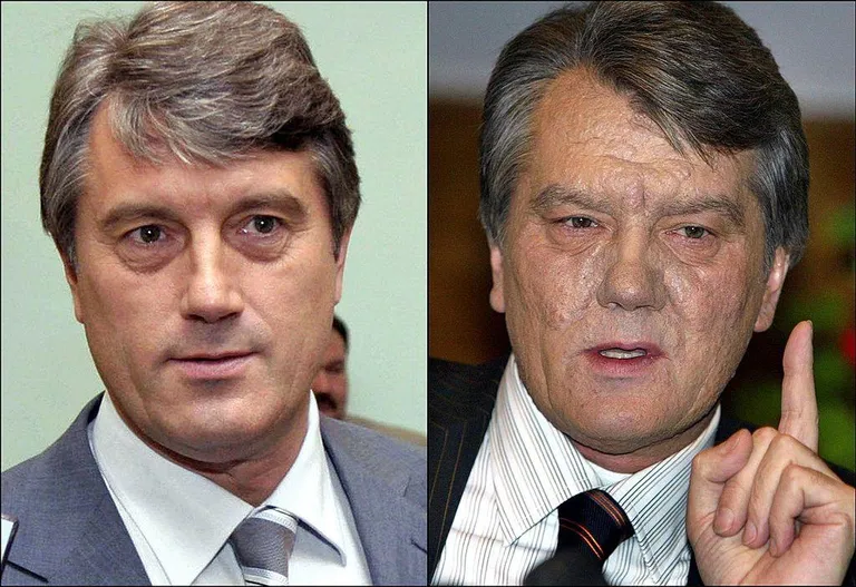 Ющенко в сентябре пережил попытку отравления диоксином, заказчиков так официально и не назвали. Слева — бывший премьер до отравления