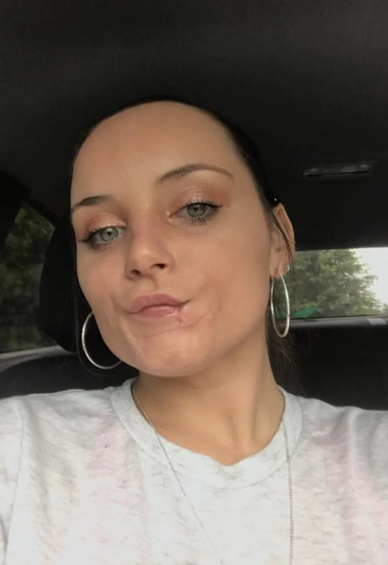 Aasta pärast rünnakut tunnistas Kayla Hayes, et ta on praegu tugevam inimene kui enne.