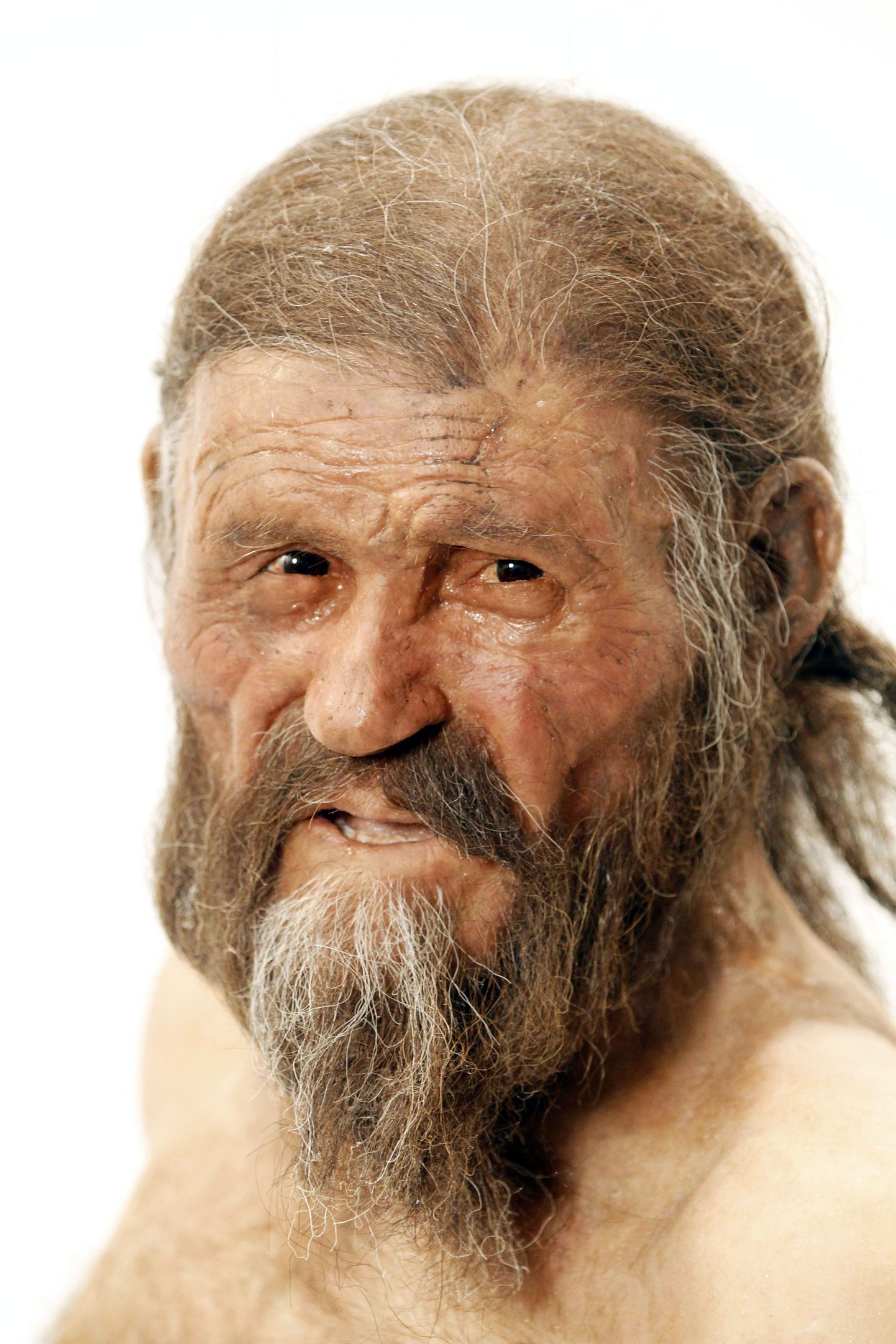 Jäämees Ötzi oleks vajanud hambaarsti