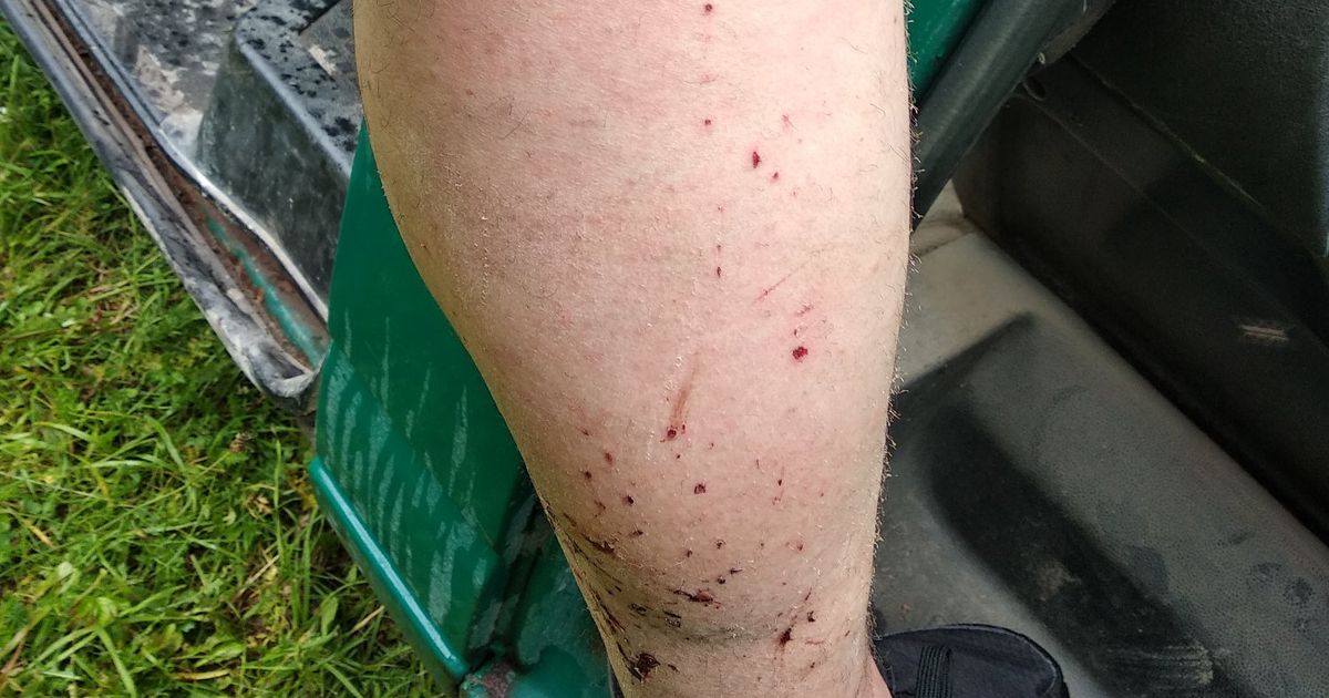 Fotod: Mees sai elektritrelli hoides piksetabamuse, kuid pääses eluga