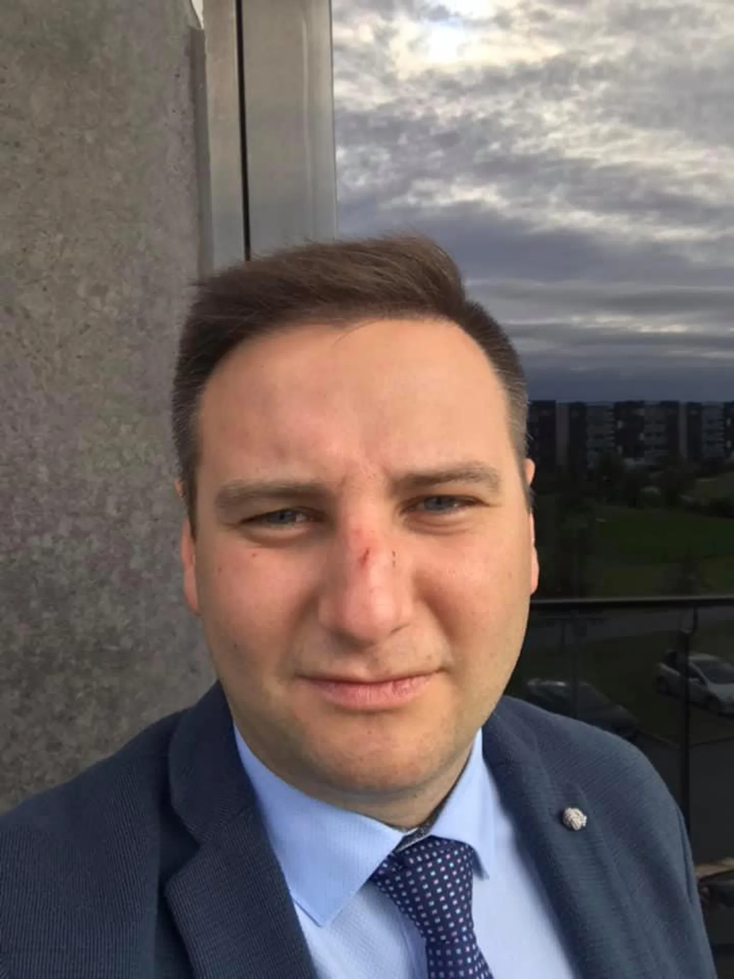Владимир Свет продемонстрировал разбитый нос.