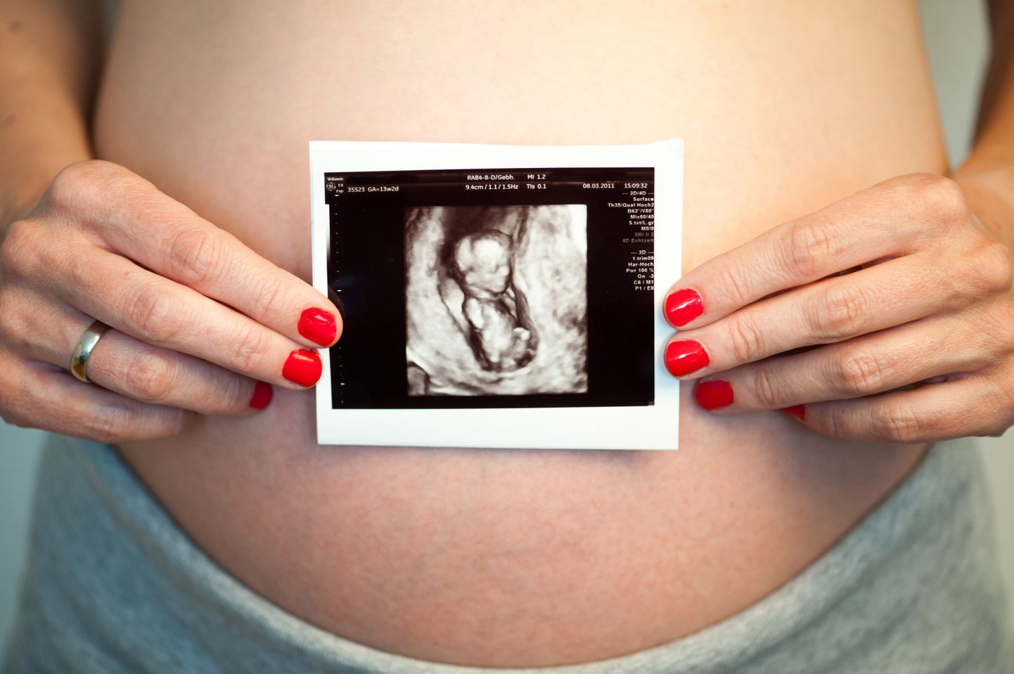Māte ar embrija ultrasonogrāfiju