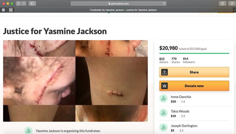 Yasmine, kes töötab haiglas õena, on loonud ka GoFundMe lehekülje «õigluse taastamiseks». Ta on juba ületanud oma esialgse eesmärgi, milleks oli koguda 15 000 dollarit. Hetkel on kogutud juba üle 20 000 dollari.