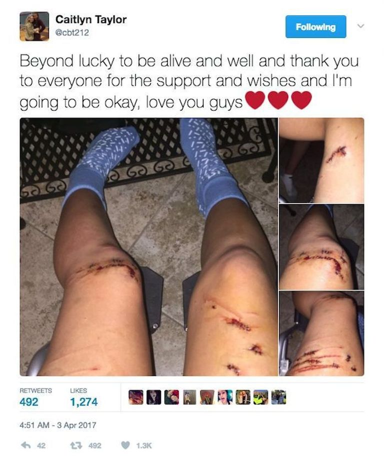 Caitlyn Taylori vigastused / Twitter.com