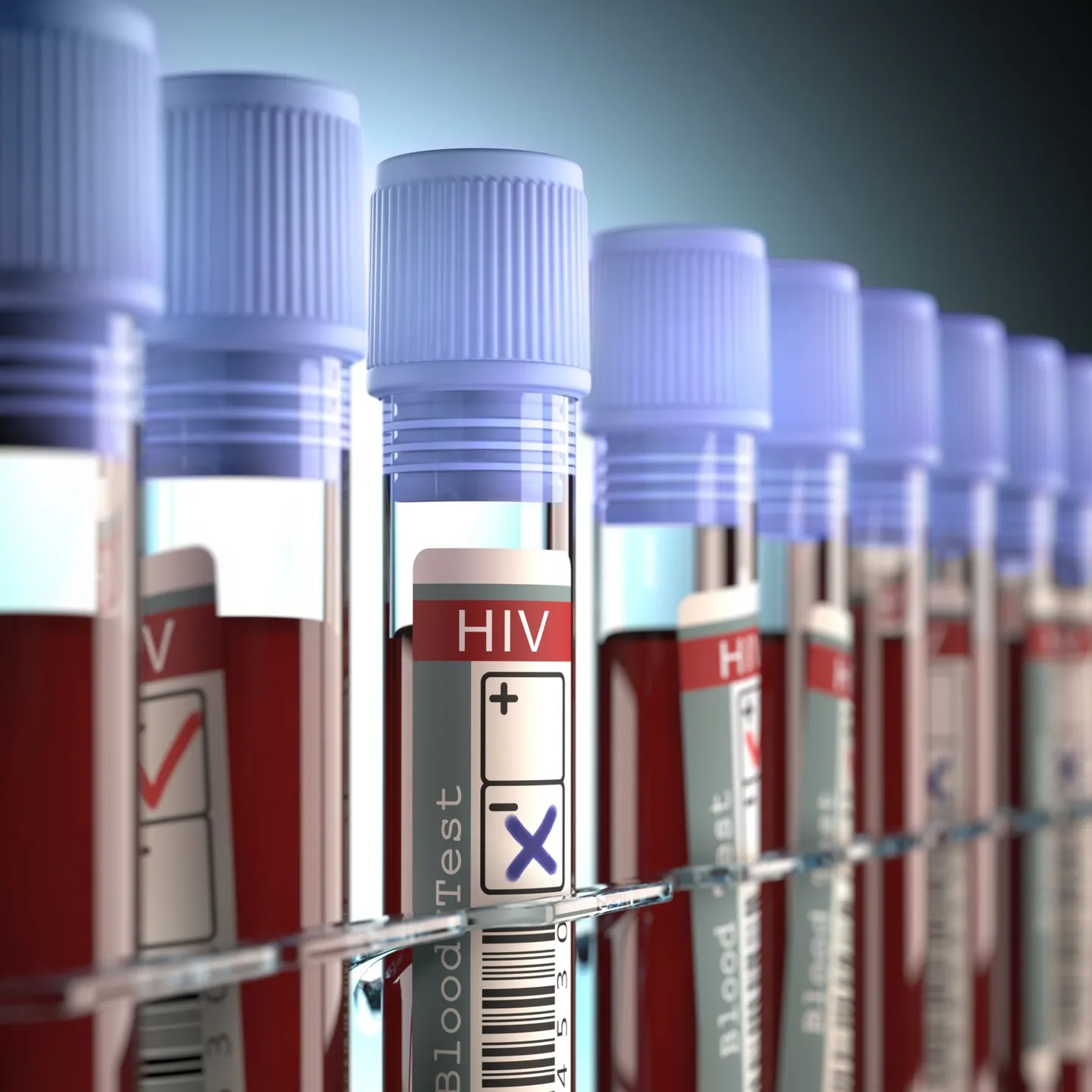 HIV diagnoosi saajate arv ei ole viimastel aastatel märkimisväärselt vähenenud.