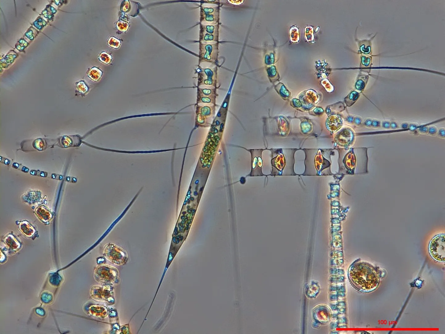 Fütoplankton mikroskoobi all nähtuna