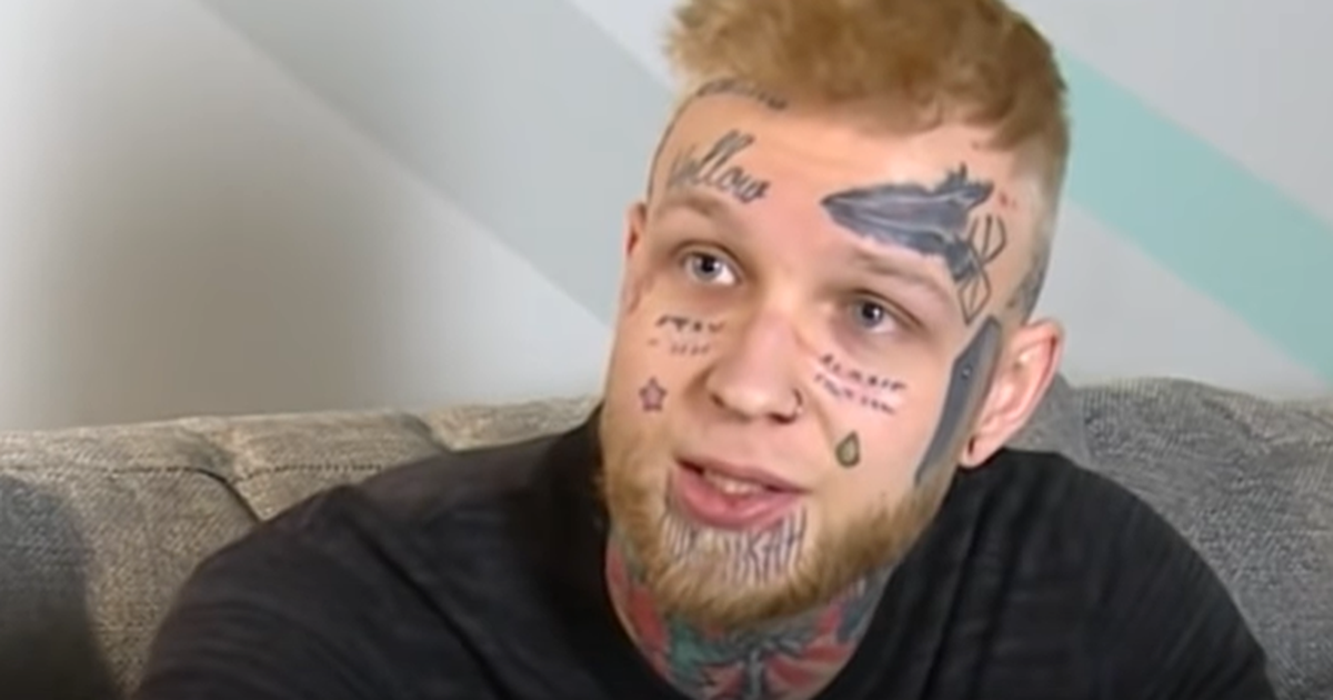 Как выглядит сын елены яковлевой после удаления татуировки лазером фото