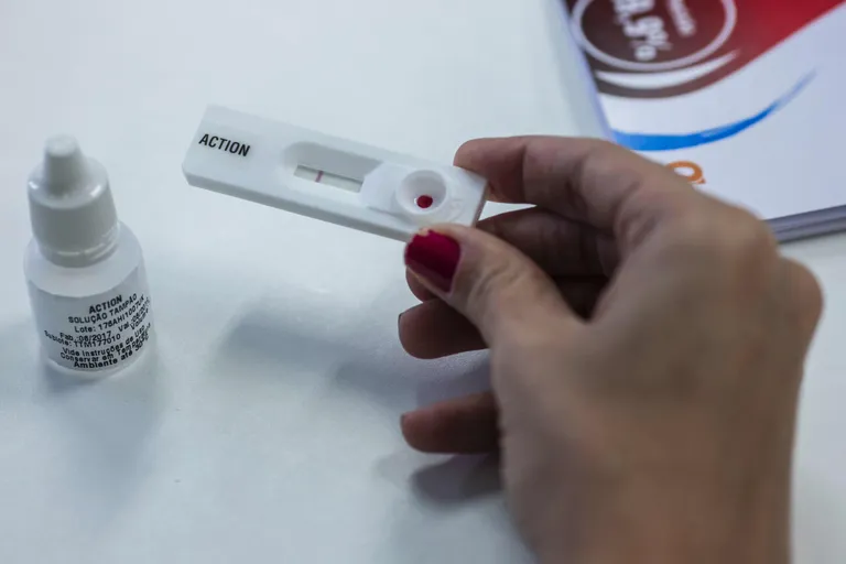 HIV kiirtest
