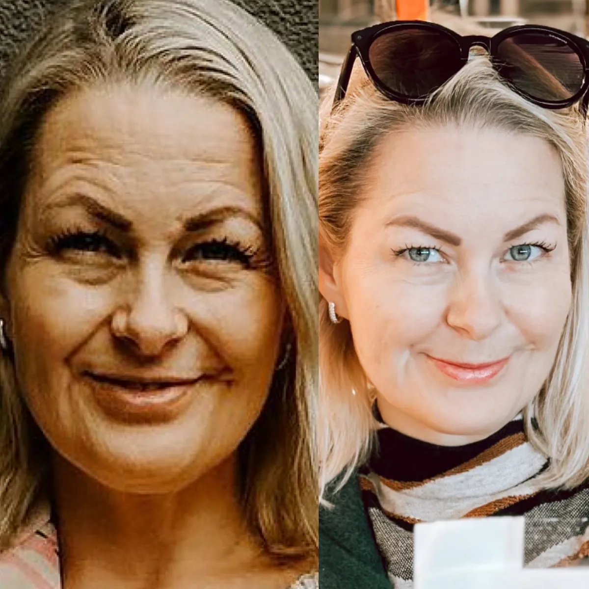 Enne ja pärast.