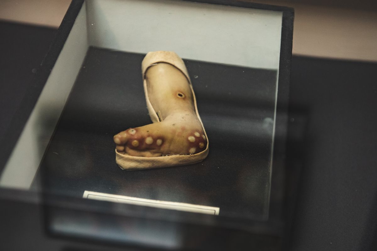 Foto: Medicīnas vēstures muzejā apskatāma izstāde par seksuālo un reproduktīvo veselību