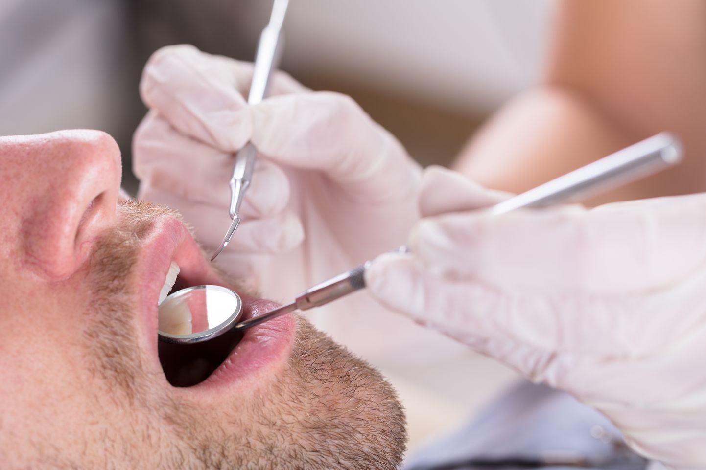 Hambaarsti teenuse pakkujaid pole piisavalt ja selle tagajärjeks on pikad järjekorrad.